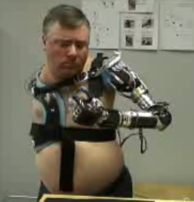 Bionic Arm being demonstrated by amputee